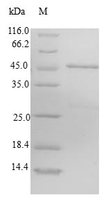 CHIC2 Protein - (Tris-Glycine gel) Discontinuous SDS-PAGE (reduced) with 5% enrichment gel and 15% separation gel.