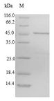 CHIC2 Protein - (Tris-Glycine gel) Discontinuous SDS-PAGE (reduced) with 5% enrichment gel and 15% separation gel.