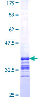 CHIC2 Protein - 12.5% SDS-PAGE Stained with Coomassie Blue.