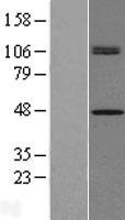 CHID1 Protein - Western validation with an anti-DDK antibody * L: Control HEK293 lysate R: Over-expression lysate