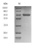 CHID1 Protein - (Tris-Glycine gel) Discontinuous SDS-PAGE (reduced) with 5% enrichment gel and 15% separation gel.