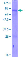 CHID1 Protein - 12.5% SDS-PAGE of human CHID1 stained with Coomassie Blue