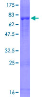 CHIT1 / Chitotriosidase Protein - 12.5% SDS-PAGE of human CHIT1 stained with Coomassie Blue