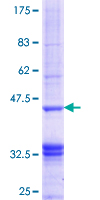 CHIT1 / Chitotriosidase Protein - 12.5% SDS-PAGE Stained with Coomassie Blue.