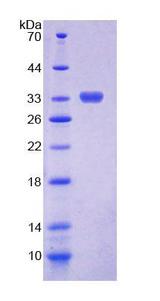 CHIT1 / Chitotriosidase Protein - Recombinant  Chitinase 1 By SDS-PAGE