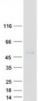 CHIT1 / Chitotriosidase Protein - Purified recombinant protein CHIT1 was analyzed by SDS-PAGE gel and Coomassie Blue Staining