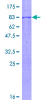 CHKA / CK / Choline Kinase Protein - 12.5% SDS-PAGE of human CHKA stained with Coomassie Blue