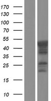 CHKB / CHKL Protein - Western validation with an anti-DDK antibody * L: Control HEK293 lysate R: Over-expression lysate