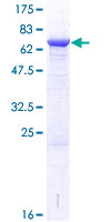 CHKB / CHKL Protein - 12.5% SDS-PAGE of human CHKB stained with Coomassie Blue