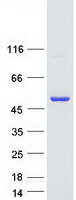 CHKB / CHKL Protein - Purified recombinant protein CHKB was analyzed by SDS-PAGE gel and Coomassie Blue Staining