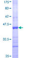 CHL1 Protein - 12.5% SDS-PAGE Stained with Coomassie Blue.