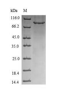 CHM / REP1 Protein - (Tris-Glycine gel) Discontinuous SDS-PAGE (reduced) with 5% enrichment gel and 15% separation gel.