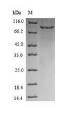 CHM / REP1 Protein - (Tris-Glycine gel) Discontinuous SDS-PAGE (reduced) with 5% enrichment gel and 15% separation gel.