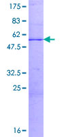 CHMP1A Protein - 12.5% SDS-PAGE of human PCOLN3 stained with Coomassie Blue