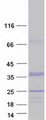 CHMP1A Protein - Purified recombinant protein CHMP1A was analyzed by SDS-PAGE gel and Coomassie Blue Staining