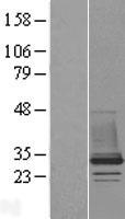 CHMP1B Protein - Western validation with an anti-DDK antibody * L: Control HEK293 lysate R: Over-expression lysate