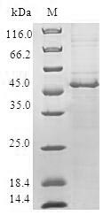 CHMP1B Protein - (Tris-Glycine gel) Discontinuous SDS-PAGE (reduced) with 5% enrichment gel and 15% separation gel.
