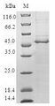 CHMP1B Protein - (Tris-Glycine gel) Discontinuous SDS-PAGE (reduced) with 5% enrichment gel and 15% separation gel.