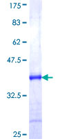 CHMP1B Protein - 12.5% SDS-PAGE Stained with Coomassie Blue