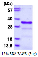 CHMP1B Protein