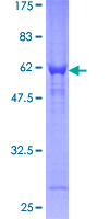 CHMP2A Protein - 12.5% SDS-PAGE of human CHMP2A stained with Coomassie Blue