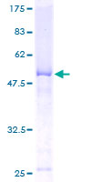 CHMP2B Protein - 12.5% SDS-PAGE of human CHMP2B stained with Coomassie Blue