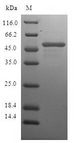 CHMP2B Protein - (Tris-Glycine gel) Discontinuous SDS-PAGE (reduced) with 5% enrichment gel and 15% separation gel.