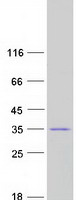 CHMP2B Protein - Purified recombinant protein CHMP2B was analyzed by SDS-PAGE gel and Coomassie Blue Staining