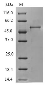 CHMP4B Protein - (Tris-Glycine gel) Discontinuous SDS-PAGE (reduced) with 5% enrichment gel and 15% separation gel.
