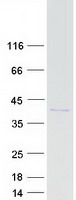 CHMP4B Protein - Purified recombinant protein CHMP4B was analyzed by SDS-PAGE gel and Coomassie Blue Staining