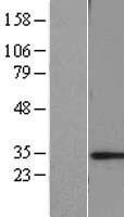 CHMP6 Protein - Western validation with an anti-DDK antibody * L: Control HEK293 lysate R: Over-expression lysate