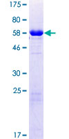 CHMP6 Protein - 12.5% SDS-PAGE of human CHMP6 stained with Coomassie Blue