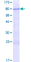 CHMP7 Protein - 12.5% SDS-PAGE of human CHMP7 stained with Coomassie Blue