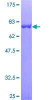 CHN1 Protein - 12.5% SDS-PAGE of human CHN1 stained with Coomassie Blue
