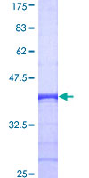 CHN1 Protein - 12.5% SDS-PAGE Stained with Coomassie Blue.