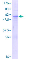 CHODL / Chondrolectin Protein - 12.5% SDS-PAGE of human CHODL stained with Coomassie Blue