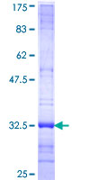 CHODL / Chondrolectin Protein - 12.5% SDS-PAGE Stained with Coomassie Blue.