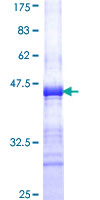 Chondroadherin / CHAD Protein - 12.5% SDS-PAGE Stained with Coomassie Blue.