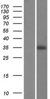CHORDC1 / CHP1 Protein - Western validation with an anti-DDK antibody * L: Control HEK293 lysate R: Over-expression lysate