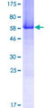 CHORDC1 / CHP1 Protein - 12.5% SDS-PAGE of human CHORDC1 stained with Coomassie Blue