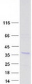 CHORDC1 / CHP1 Protein - Purified recombinant protein CHORDC1 was analyzed by SDS-PAGE gel and Coomassie Blue Staining
