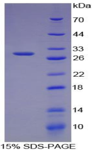 Chordin Protein - Recombinant Chordin By SDS-PAGE