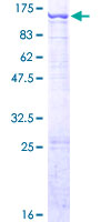 CHPF2 / CSGLCAT Protein - 12.5% SDS-PAGE of human CHPF2 stained with Coomassie Blue