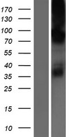 CHPT1 Protein - Western validation with an anti-DDK antibody * L: Control HEK293 lysate R: Over-expression lysate