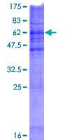CHPT1 Protein - 12.5% SDS-PAGE of human CHPT1 stained with Coomassie Blue