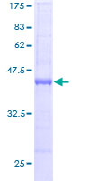 CHRAC1 Protein - 12.5% SDS-PAGE of human CHRAC1 stained with Coomassie Blue