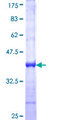 CHRAC1 Protein - 12.5% SDS-PAGE Stained with Coomassie Blue.