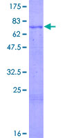 CHRDL1 Protein - 12.5% SDS-PAGE of human CHRDL1 stained with Coomassie Blue
