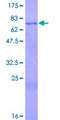 CHRDL1 Protein - 12.5% SDS-PAGE of human CHRDL1 stained with Coomassie Blue