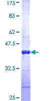 CHRDL1 Protein - 12.5% SDS-PAGE Stained with Coomassie Blue.